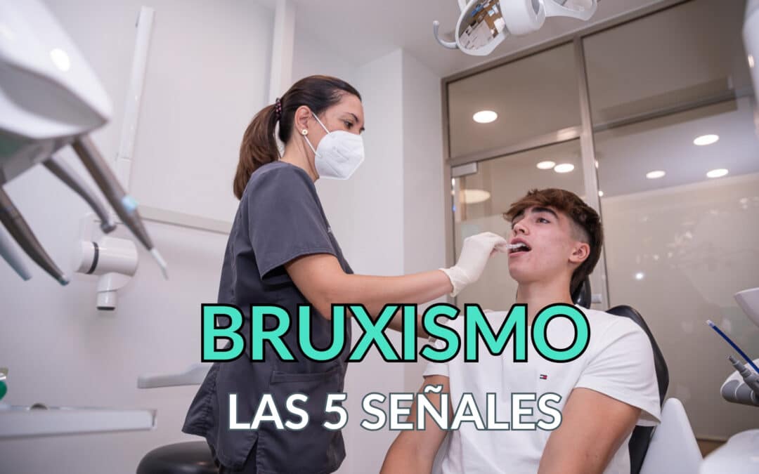 Cómo saber si tengo bruxismo: 5 señales que nunca fallan