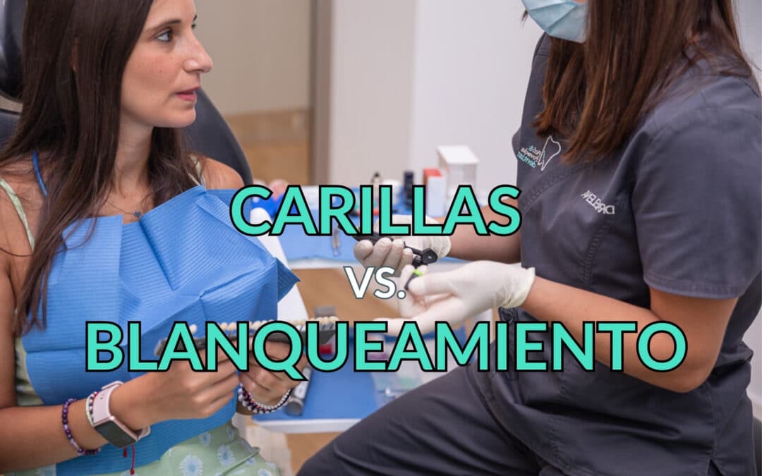 blanqueamiento o carillas cual es mejor