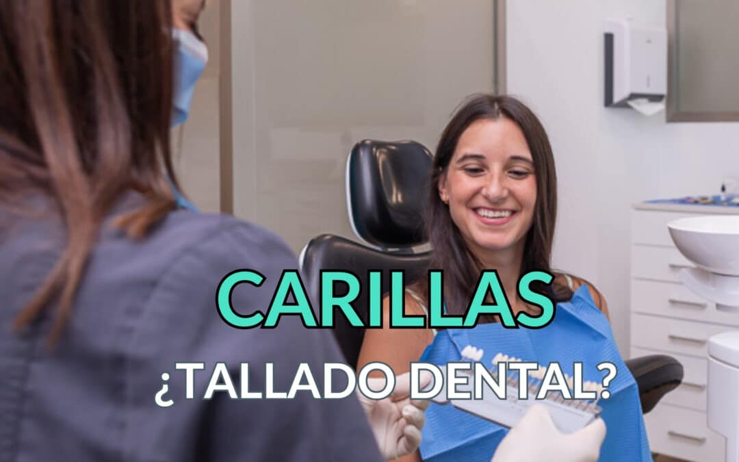 ¿Es necesario limar los dientes para hacer carillas dentales?