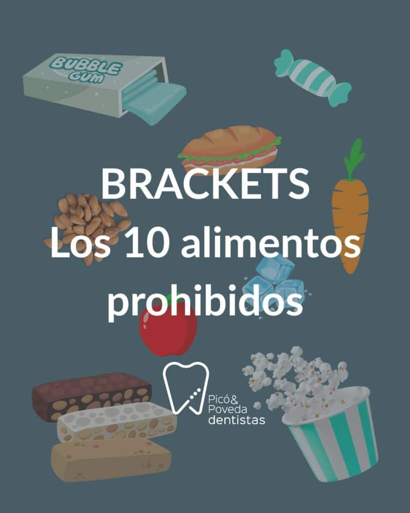 que no puedes comer con brackets 10 alimentos prohibidos