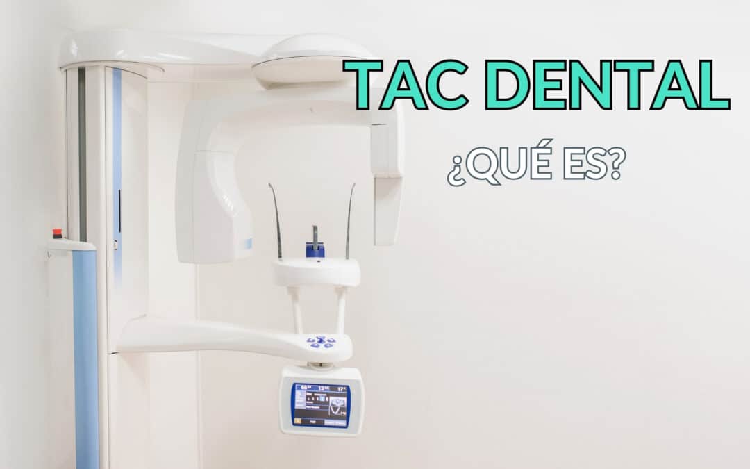 Qué es y para qué sirve un TAC Dental