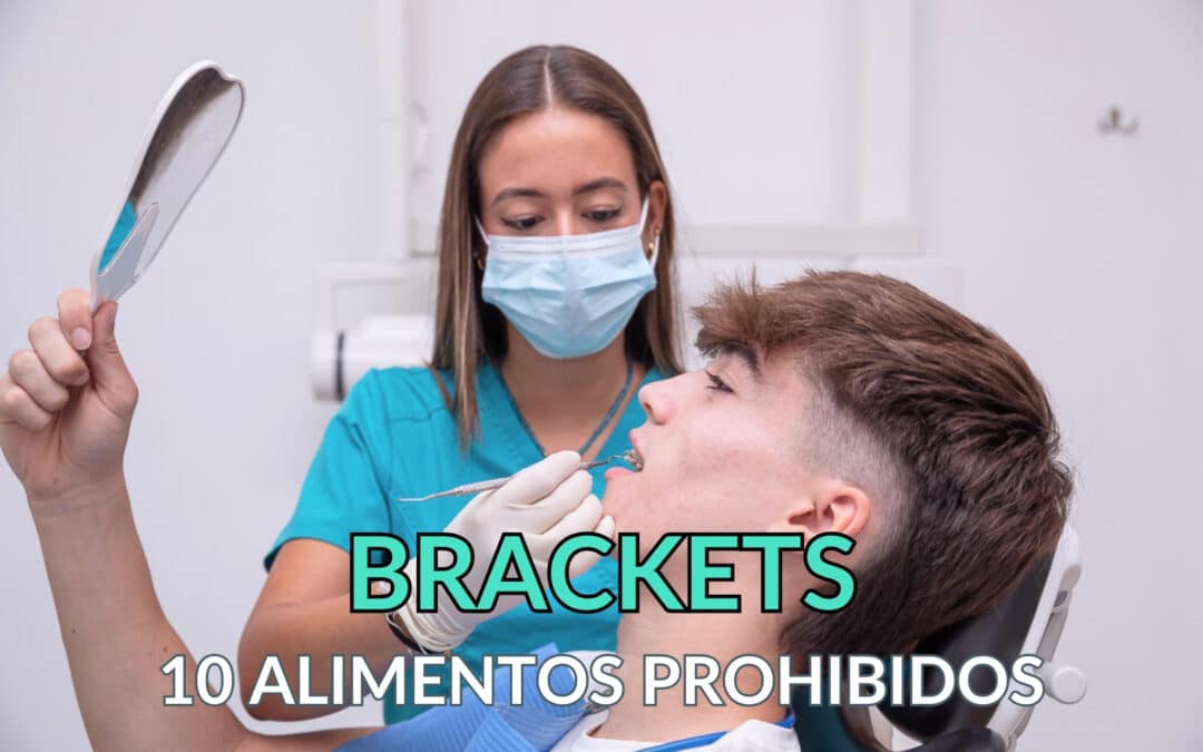 Los 10 alimentos prohibidos que no puedes comer con brackets