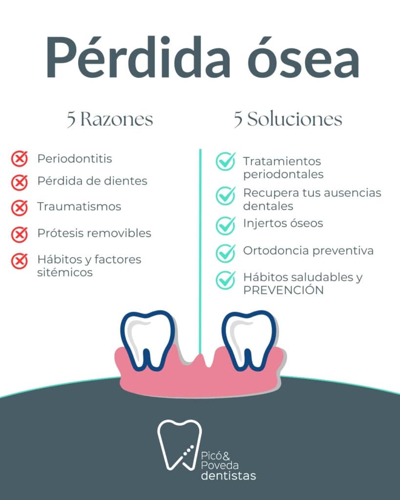 5 razones y soluciones de la pérdida del hueso dental