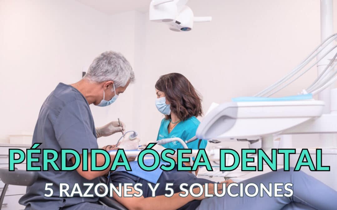 ¿Por qué se pierde el hueso dental? 5 razones y 5 soluciones